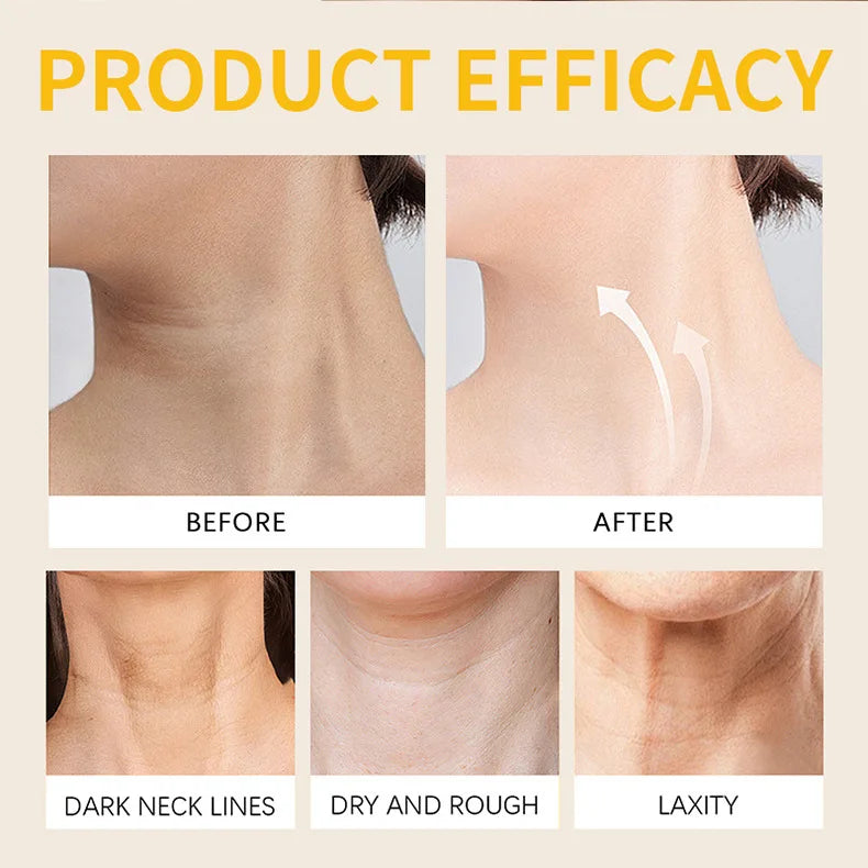 Bee Venom Wrinkle Remove Face Cream Anti-aging Neck Lifting Firming Cream Moisturizing Tender Soften Skin Whitening 50g