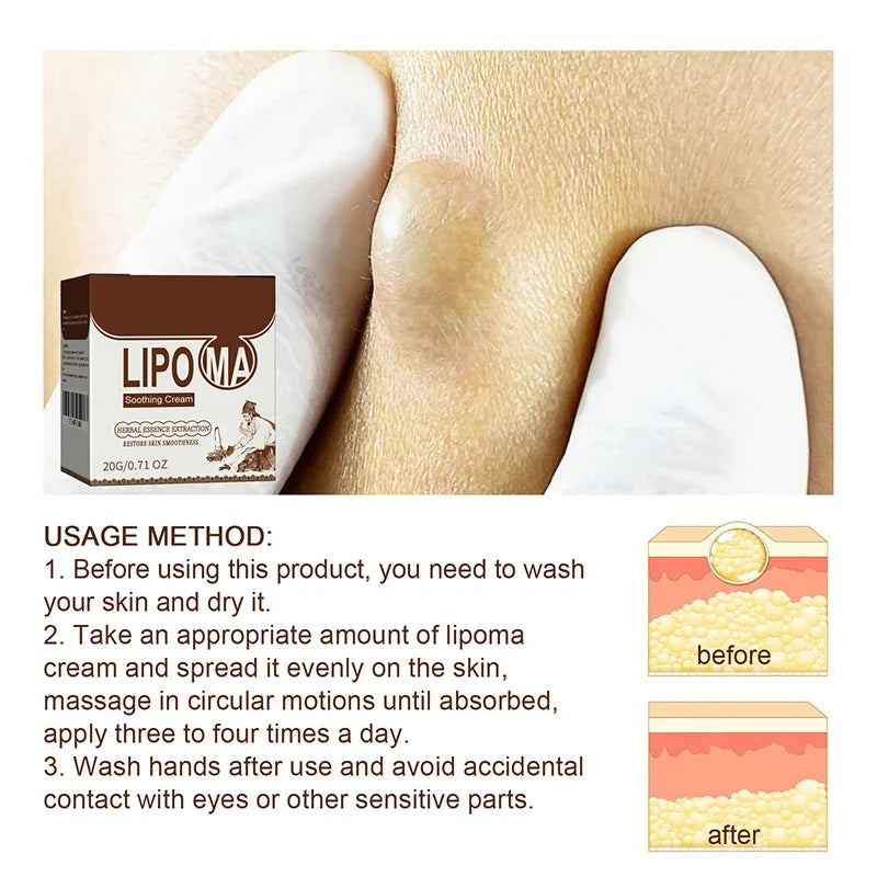 Skin Care Soothing  Knot Care Cream Subcutaneous Lumps Remover Relieves Body Agglomeration Hard Blocks Body Skin Care Cream