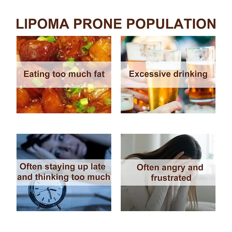 Skin Care Soothing  Knot Care Cream Subcutaneous Lumps Remover Relieves Body Agglomeration Hard Blocks Body Skin Care Cream