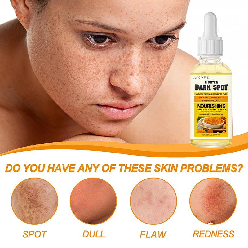 Turmeric Serum Moisturizing Facial Skin Essence  Niacinamide Hyaluronic Acid Daily Care