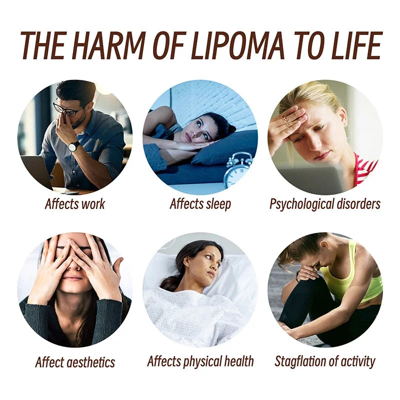 Skin Care Soothing  Knot Care Cream Subcutaneous Lumps Remover Relieves Body Agglomeration Hard Blocks Body Skin Care Cream