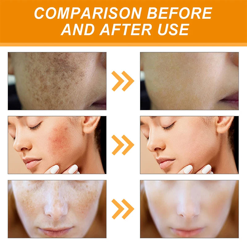 Turmeric Serum Moisturizing Facial Skin Essence  Niacinamide Hyaluronic Acid Daily Care